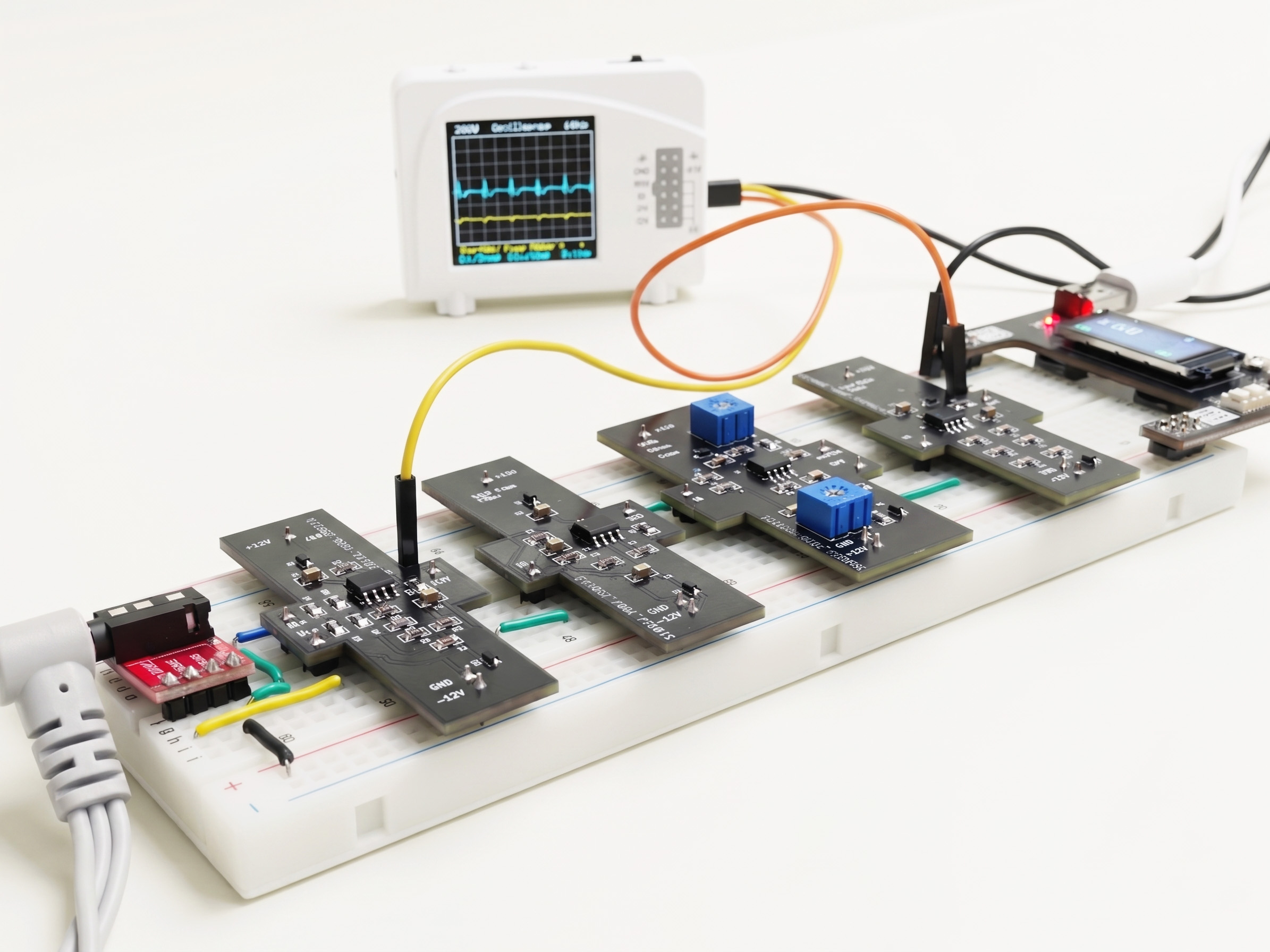 Integrated ECG Signal Processing System Project Showcase